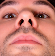 Before - Más aire al dormir